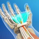 Carpel Tunnel Syndrome